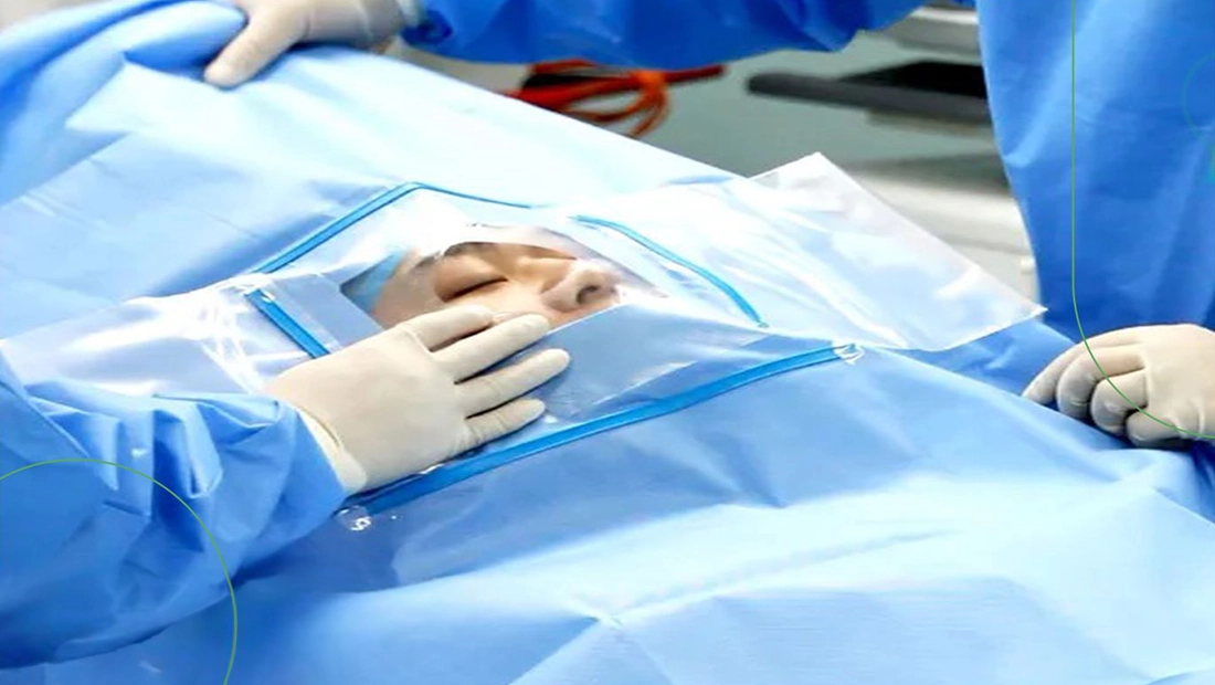 Clear Vision in Surgery: Unveiling Ophthalmic Drapes